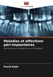 Maladies et affections péri-implantaires: Une mise à jour clinique sur ce qu'il faut savoir