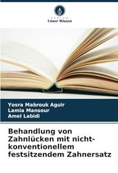Behandlung von Zahnlücken mit nicht-konventionellem festsitzendem Zahnersatz