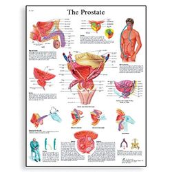3B Scientific Tablica do nauki The Prostate Gland Diagram