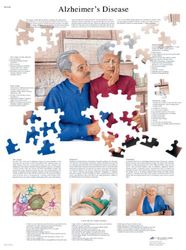 3B Scientific Anatomie humaine - Tableau des maladies d'Alzheimer, version plastifiée