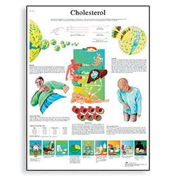 3B Scientific Anatomia człowieka - tabela cholesterolu, wersja papierowa
