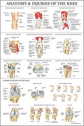 Palace Learning Poster plastifié Anatomie et blessures du genou – Tableau anatomique de l'articulation du genou – 45,7 x 61 cm