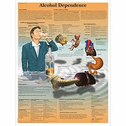3B Scientific Anatomia człowieka - tabela zależności od alkoholu, wersja papierowa