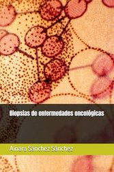 Biopsias de enfermedades oncológicas