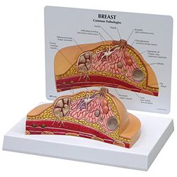 3B Scientific 1019559 Breast Cross-Section Model