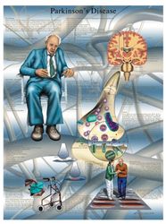 3B Scientific Tableau des maladies de Parkinson Version plastifiée