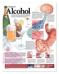 Dangers of Alcohol Anatomical Chart