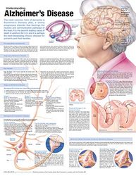 Understanding Alzheimer's Disease anatomiskt diagram