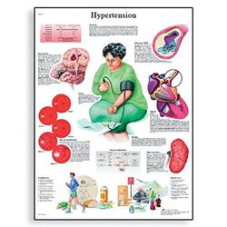 3B Scientific Vetenskaplig mänsklig anatomi – hypertensionschapp, pappersversion