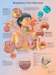 3B Scientific VR1253L anatomia człowieka - wykres infekcji dróg oddechowych, wersja laminowana