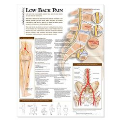 Anatomical Chart Company: Understanding Low Back Pain Anatom