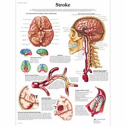 3B Scientific Vetenskaplig strokediagram, unlaminated