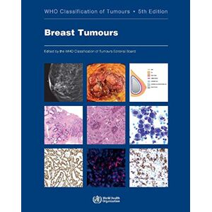 Who Classification of Tumours Editorial Board - BREAST TUMOURS 5/E: Who Classification of Tumours (World Health Organization Classification of Tumours, Band 2)