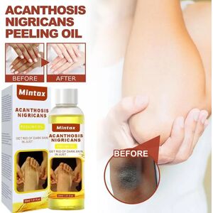 30ml Peeling Oil Dark Skin Bleaching Remove Arm Knee Scrub Dead Body Lightening Exfoliating Serum Whitening Skin Legs Melan Q9M3