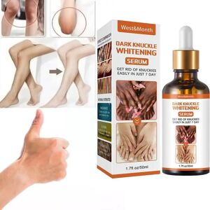 Get Rid Of Dark Knuckles In 7 Days Serum Whitening Removing Dark Knuckles Serum Hand Knuckle Eraser Serum For Elbow And Knee