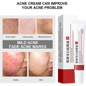 Whitening Freckle Cream Effective Remove Dark Spots Anti Freckle Cream Fade Pigmentation Melasma Brighten Cream