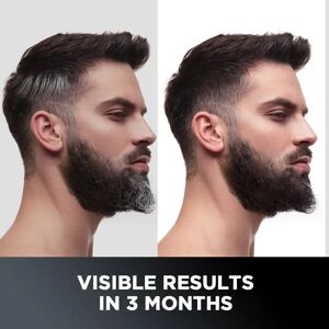 The Man Company Anti-Graying Hair & Beard Serum Arcolys & Bhringraj