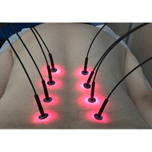 Sistema de Agulha de Luz Light Needle 8 Fibras: Converte 1 laser em 8 pontos de saída ao mesmo tempo