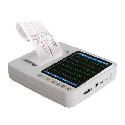 Máquina de ECG de 7 Pulgadas y 12 Derivaciones con IA para Mascotas Veterinarias, Monitor Digital Portátil de Animales, ECG de 3 Canales