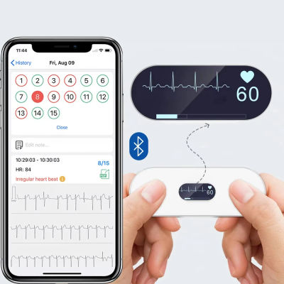 Monitor de ECG Portátil con Pantalla OLED y Conectividad Bluetooth, Compatible con Monitoreo de ECG y Monitoreo Cardíaco