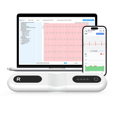 Monitor ECG monitor holter | Resultados fáciles en 30S-24H | Análisis AI gratuito Recordar ECUOS de un solo plomo en la marcha y detectar irregulares