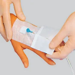 SMITH&NEPHEW Applica I V 100 8 x 6 cm 50 Stück