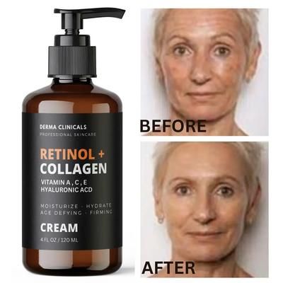 Retinol + Collagen, Hyaluronic Acid, Vitamin C AntiAging Wrinkle Serum Cream 4oz Retinol + Collagen, Hyaluronic Acid, Vitamin C AntiAging Wrinkle Serum Cream 4oz