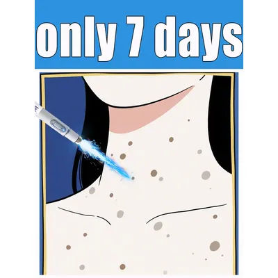Generation-2 laser says goodbye to all warts in 7 days