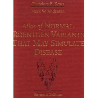 Atlas of Normal Roentgen Variants That May Simulate Disease, 7e