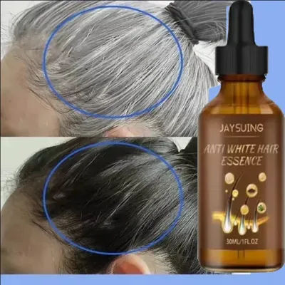 White hair killer, remove gray hair and restore natural hair color in 7 days