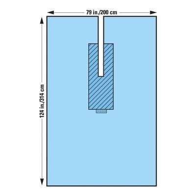 Surgical Drape U-Drape 80 W X 124 L Inch Sterile (440680_CS)