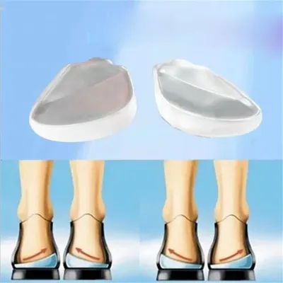 2Pcs Gel Pillow Silicone Insoles Shoes Pad Pugel X/O-type Legs Corrector Orthopedic Insoles Heel Cup