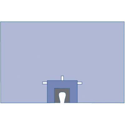 Medline Shoulder Split Drape, Sterile, Hook and Loop Style Line Holders, 100" x 66", 8/CS (DYNJP8403)