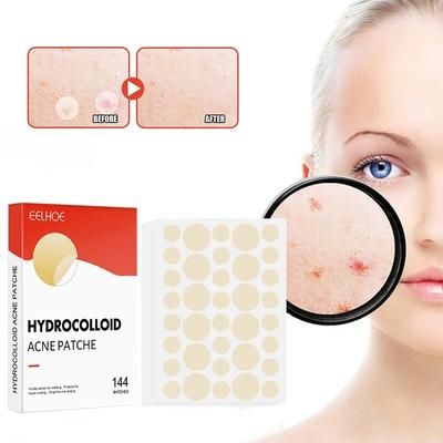 Professional Acne Patches, High End Skin Care Pimple Stickers For Healing & Absorbing Spots Professional Acne Patches, High End Skin Care Pimple Stickers For Healing & Absorbing Spots