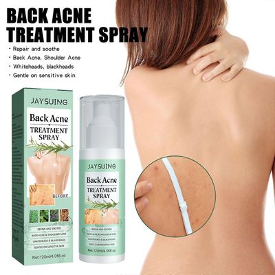 Back Akne Repair Spray Fades Pockmarks Repair Back Back Shoulder Akne