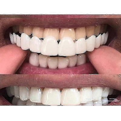 Øvre/nedre Comfort Fit Flex Whitening Protesestøtter Tw Øvre nedre tenner