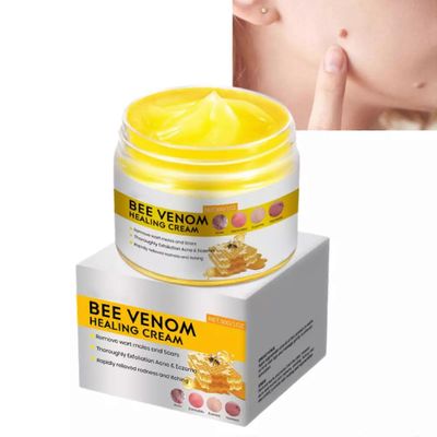 Bee Venom Skin-Tag Remover Cream Safe Natural Ingredient Ihoystävällinen voide kaikille ihotyypeille