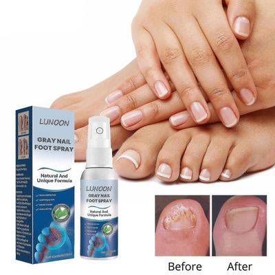 1-3kpl/Antifungals kynsihoitosuihke Medicals laatua, 30 ml, Antifungals kynsihoidot, Antifungals spray 30ml 1pcs