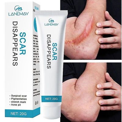 Scar fjerning krem reparasjon strekkmerker brenne akne kirurgisk akne arrsalve urte behandling gel whitening skjønnhet