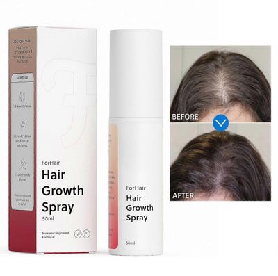 Hair Regrowth Spray - Advanced Hair Loss Solution - Edistää hiusten kasvua ja vahvistaa, rasvaton ja hormoniton koostumus estää hiustenlähtöä 1PCS