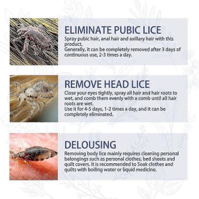 Luonnolliset täit ja syyhy poistosuihke - antibakteerinen ja kutinaa ehkäisevä päänahan hoito 3PCS