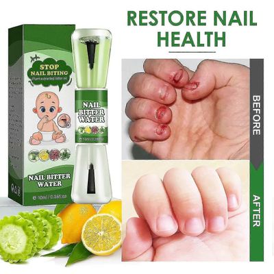 Kynsien puremishoito lapsille, 10 ml anti bite kynsilakka katkeralla maulla, kynsitikku lopettaa tehokkaasti kynsien puremisen ja peukalon imemisen...