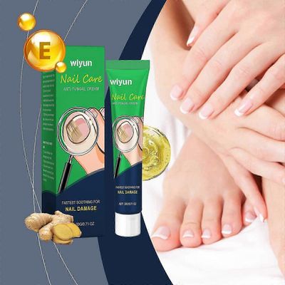 Anti-Fungaalinen varpaankynsivoide, Kynsien hoito sienilääkevoide, Kynsien sienihoito, Kynsien korjausratkaisu varpaankynsien sienelle &; Kynsien k...