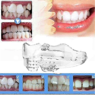 Uudet hampaat oikomishoidon hammasraudat laite hammasraudat silikoni kohdistusvalmentaja hampaiden pidike bruksismi suusuojan henkselit Cn3.1_CD Ko...