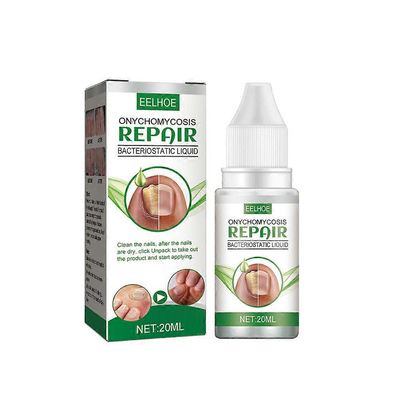 20 ml kynsienihoitonestettä, erittäin tehokas tappaa varpaankynsienen korjauksen