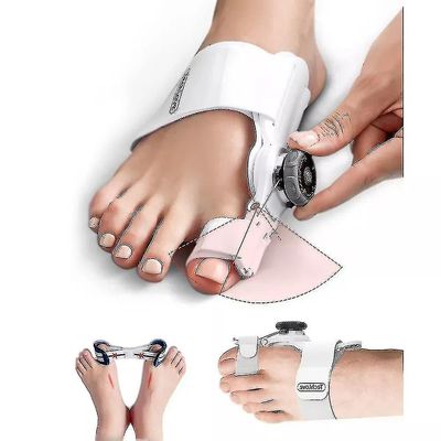 Hallux valgus, rettetang, rettetang, føtter, smertelindring, hallux valgus, korreksjon, ortopedisk tw