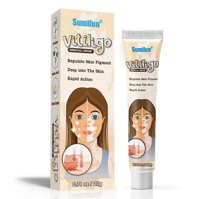 unbrand Vitiligo Fjerning Krem Vitiligo Rensing Krem Ansiktspleie Salve Hudpleie