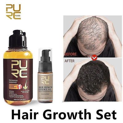 Ginger Shampoo Hair Growth Essence Olje Anti Hårtap Behandling Set ...