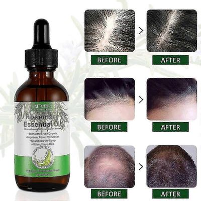 Rosmariiniöljy hiusten kasvuun ja ihonhoitoon, Rosmariinin eteerinen öljy kulmakarvojen ja ripsien kasvuun 100%