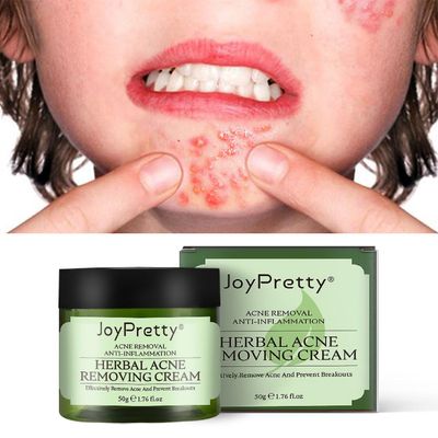 Kuankuanbao Joypretty Tea Tree akne krem fades akne print urte akne krem A